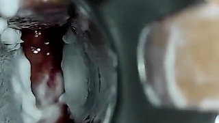 Facial, Creampie, Anal Speculum, Bukkake