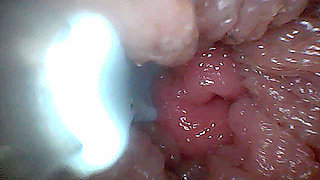 Visual Guide to G-Spot Stimulation and Orgasm - Endoscopic Perspective