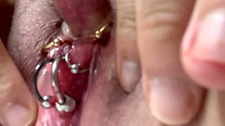 Clitoral suction