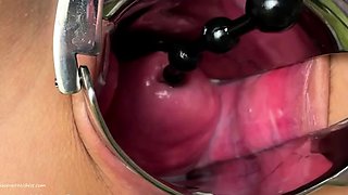 CrazyWifeSlut Fucking my cervix and peehole closeup