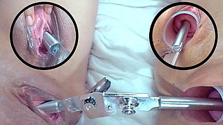 Mature Lesbians Cervix Insertion and Pee hole Fucking