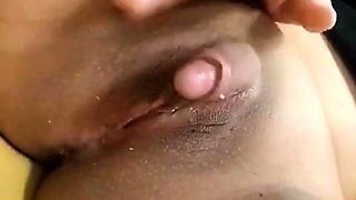 Mega Enorme Clitoris O Hermafrodita