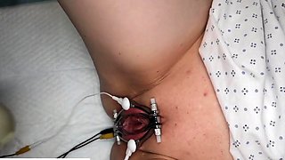 Traditional Nurse Administers Female Patient Electro Shock