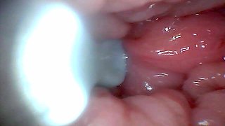 First Time: an Endoscope Reveals the G-spot up Close - Without Mounting!