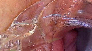 Mature Pussz Examined in Gyno Office