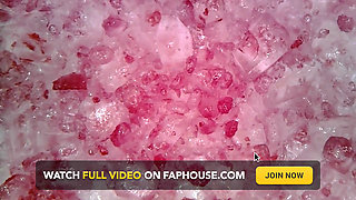 Medical Endoscope Oral Exam: Gummy Chewing, Extreme Teeth & Tongue Macro