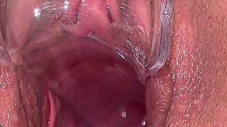 Big Clit Pussy Examined with Speculum
