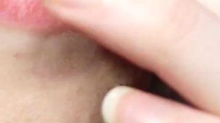 I Tell You About the Fillings in My Teeth and Dental Visits