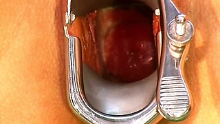 Mature Babe's Pussy Stretched Wide with Speculum and Devoured