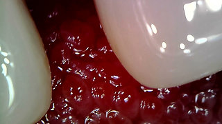 Medical Endoscope Oral Exam: Gummy Chewing, Extreme Teeth & Tongue Macro