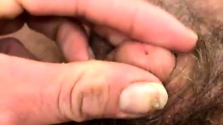 Micropenis and meth