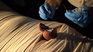 medical play fun, mummification, needle cbt and electro